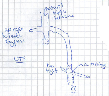 Plan of lead beyond Natural Highs traverse